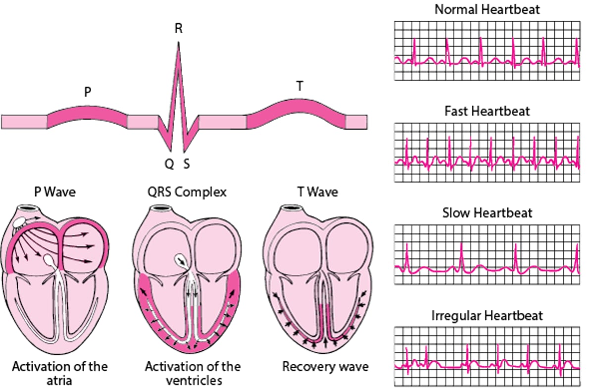 ECG : Lecture des ondes cardiaques