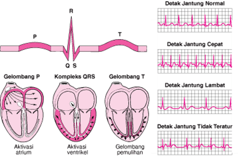 EKG: Membaca Gelombang