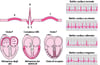 ECG: lettura delle onde