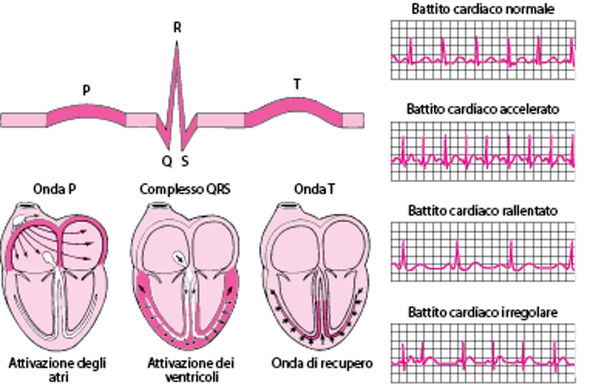 ECG: lettura delle onde