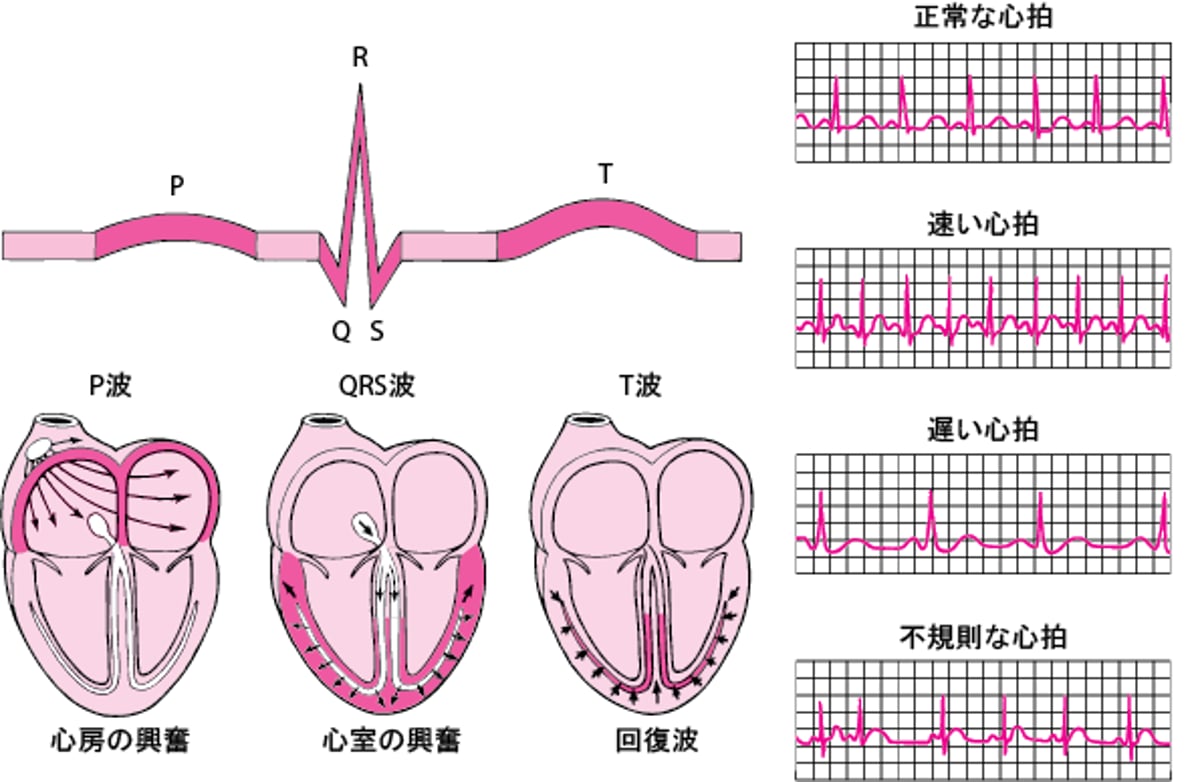 心電図：波形の読み方