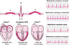 ECG: como interpretar as ondas