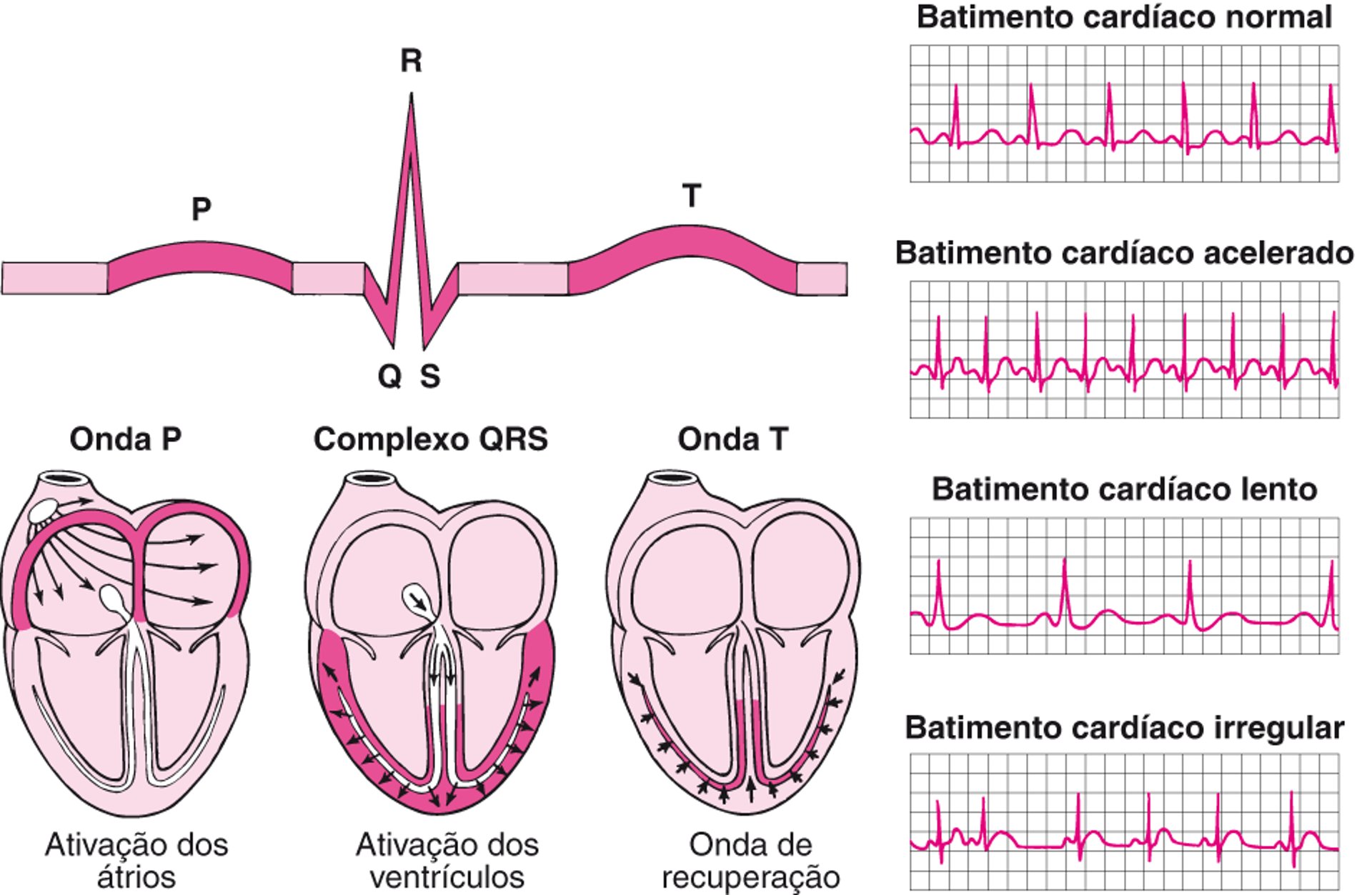 ECG: como interpretar as ondas