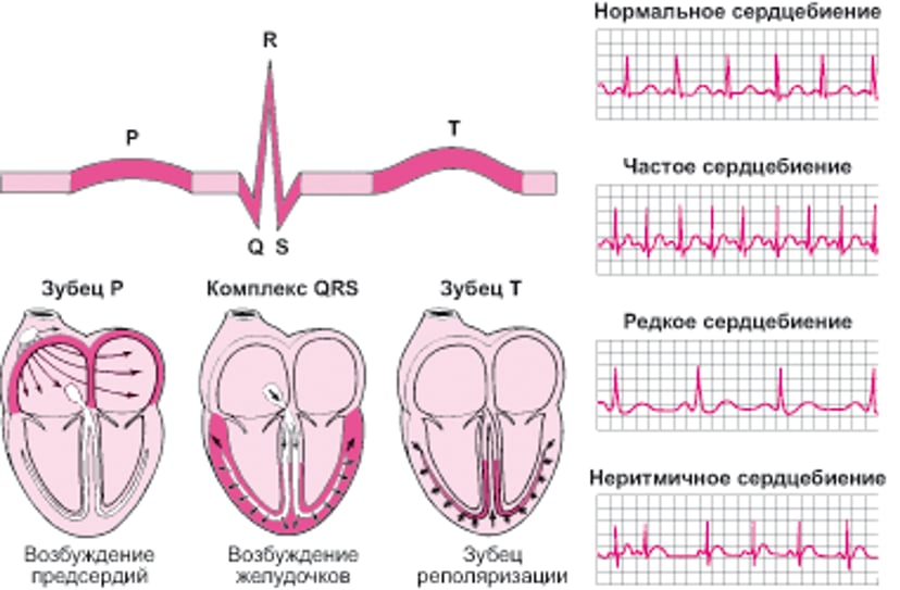 ЭКГ: интерпретация зубцов