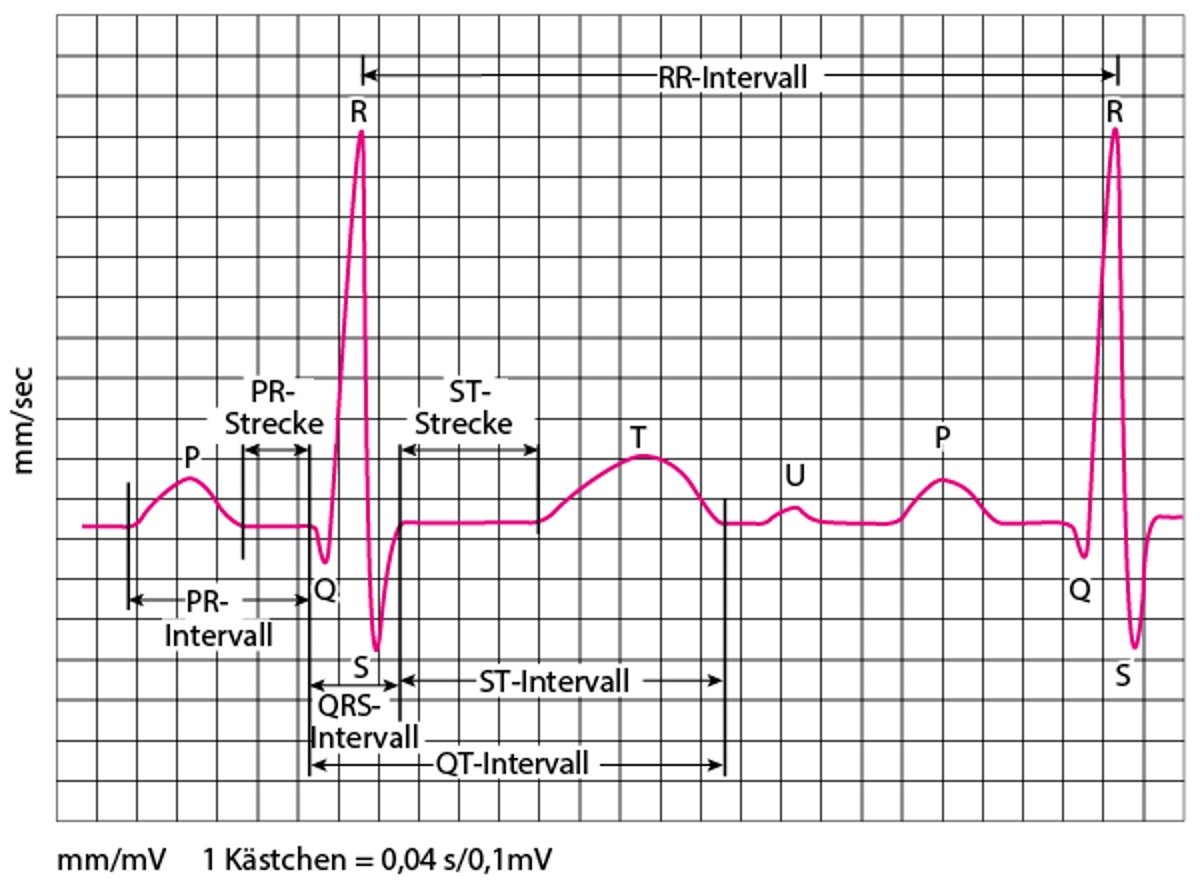 EKG: Auswertung der Kurven