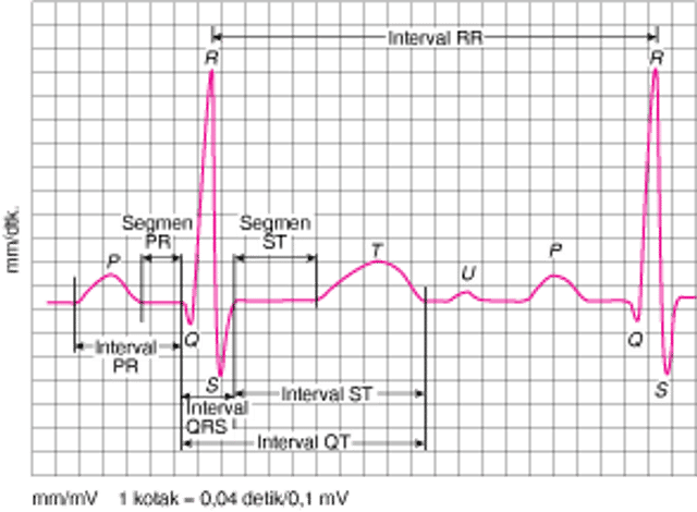 EKG: Membaca Gelombang