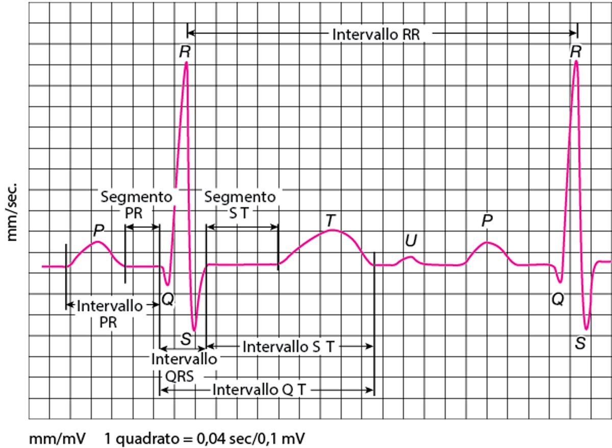 ECG: lettura delle onde