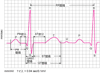 心電図：波形の読み方
