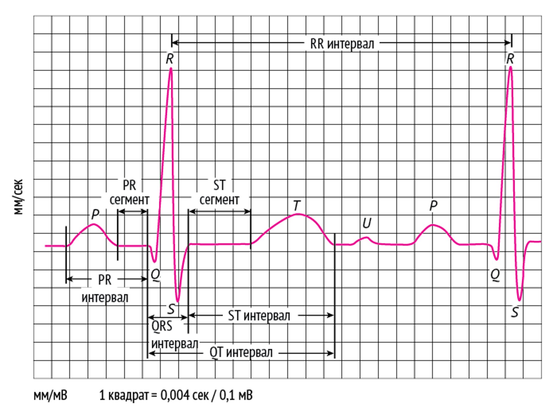 ЭКГ: интерпретация зубцов