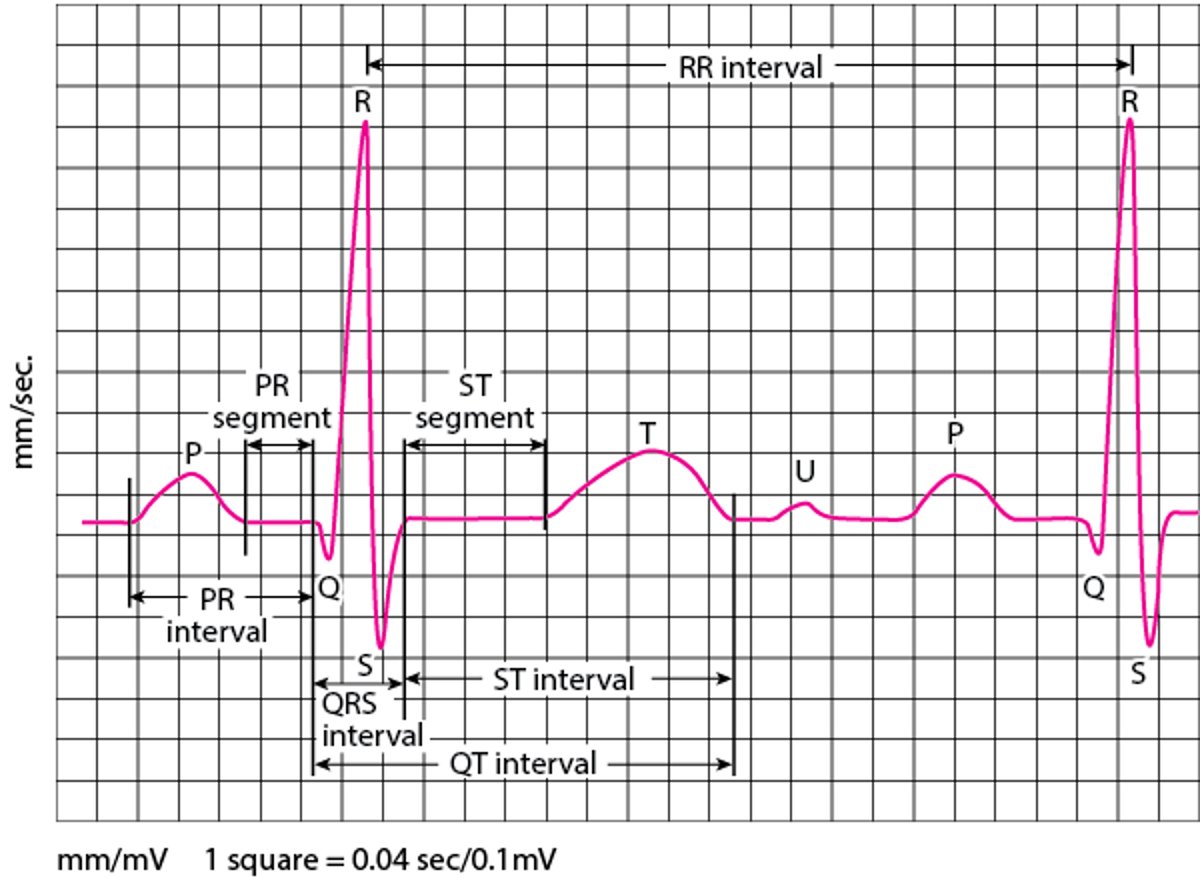 ECG：读取波形