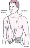 Holter Monitor: Continuous ECG Readings