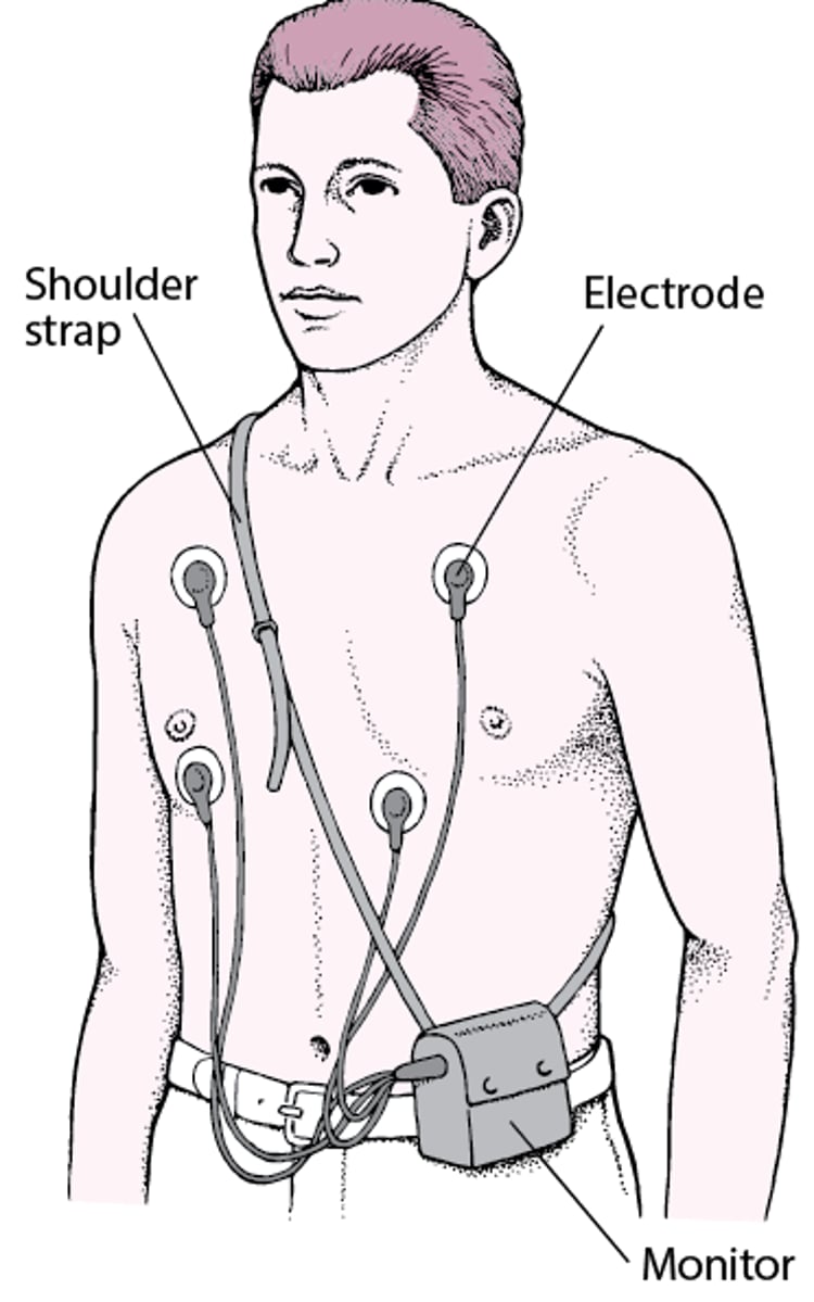 Holter Monitor: Continuous ECG Readings