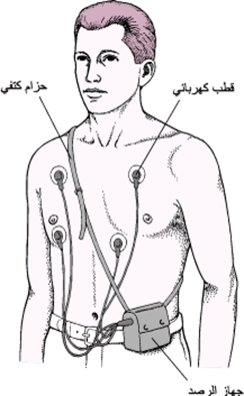 راصد هولتر: قراءاتُ تخطيط كَهربيَّة القلب الكهربائي المستمر