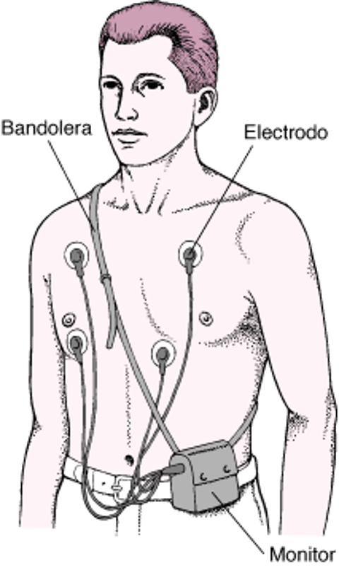 Monitor Holter: lectura continua del ECG