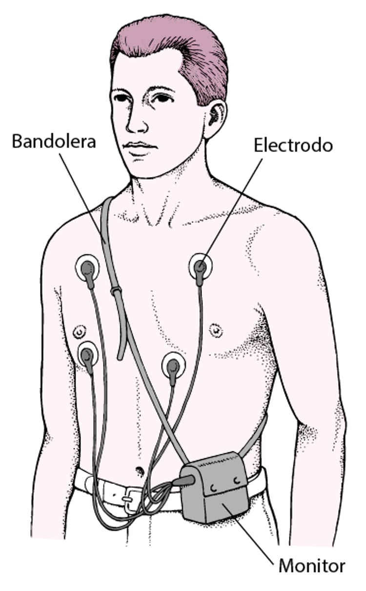 Monitor Holter: lectura continua del ECG