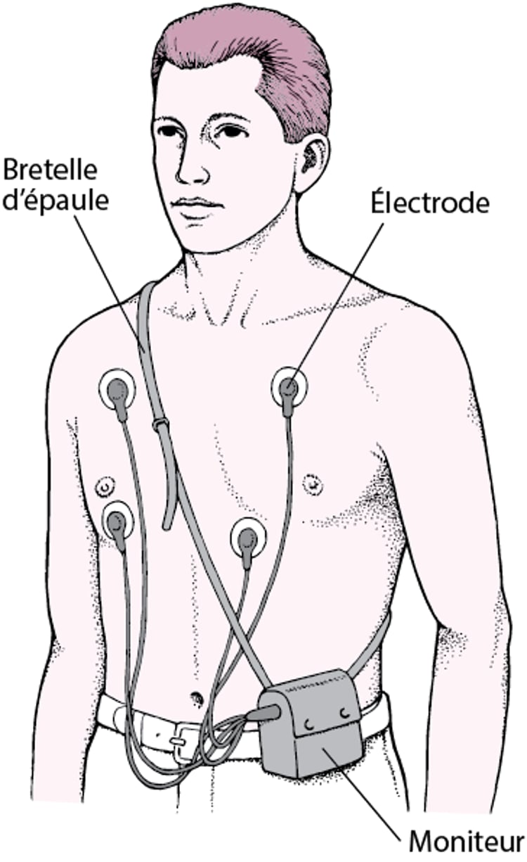 Enregistreur Holter : Des lectures ECG en continu