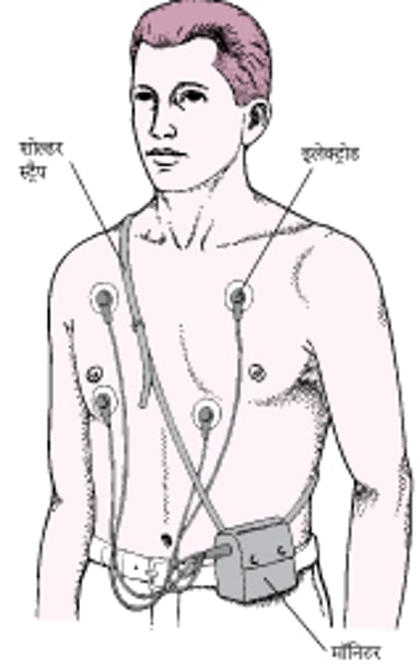 होल्टर मॉनीटर: अनवरत ECG रीडिंग