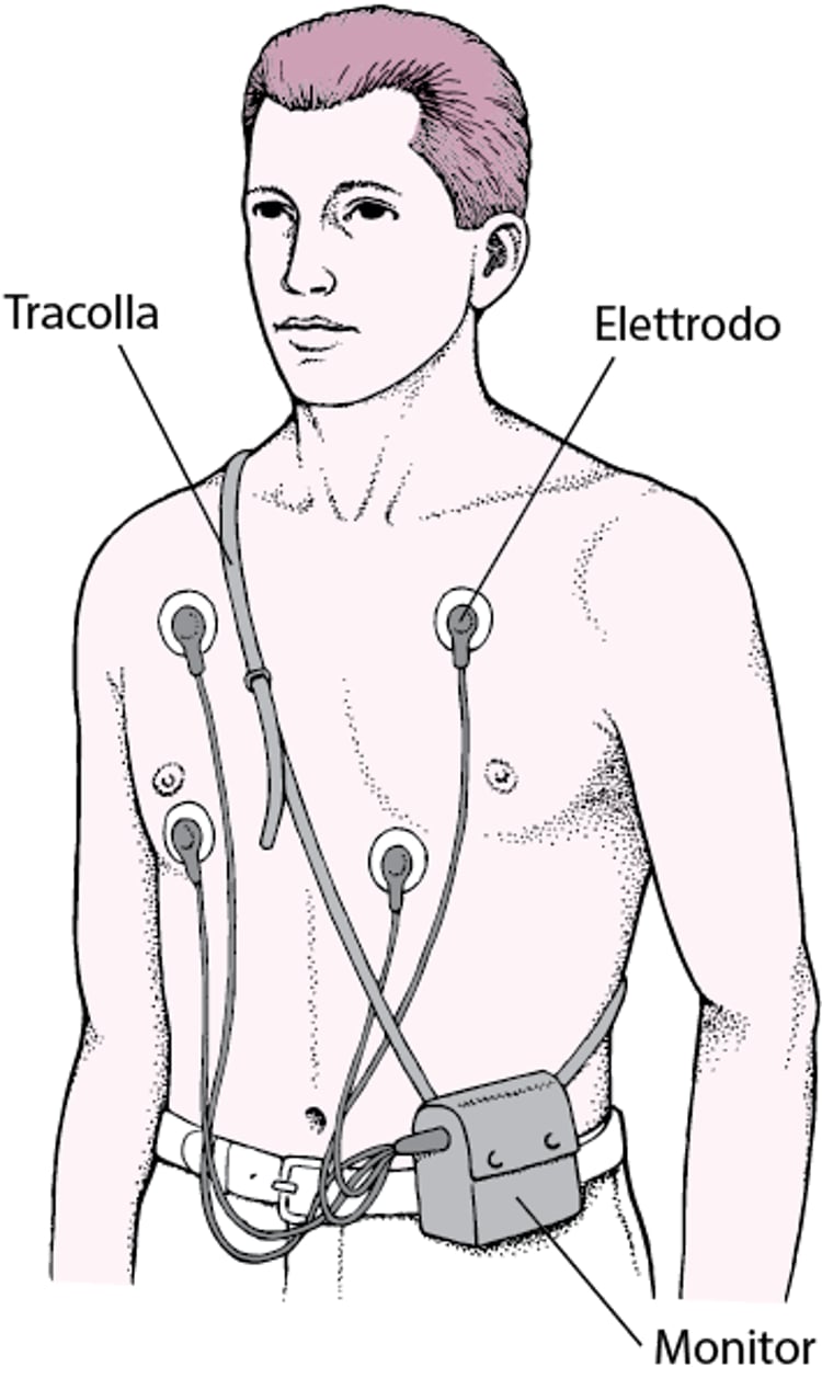 Monitoraggio Holter: lettura ECG continua