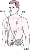 ホルター心電計による心電図の連続記録