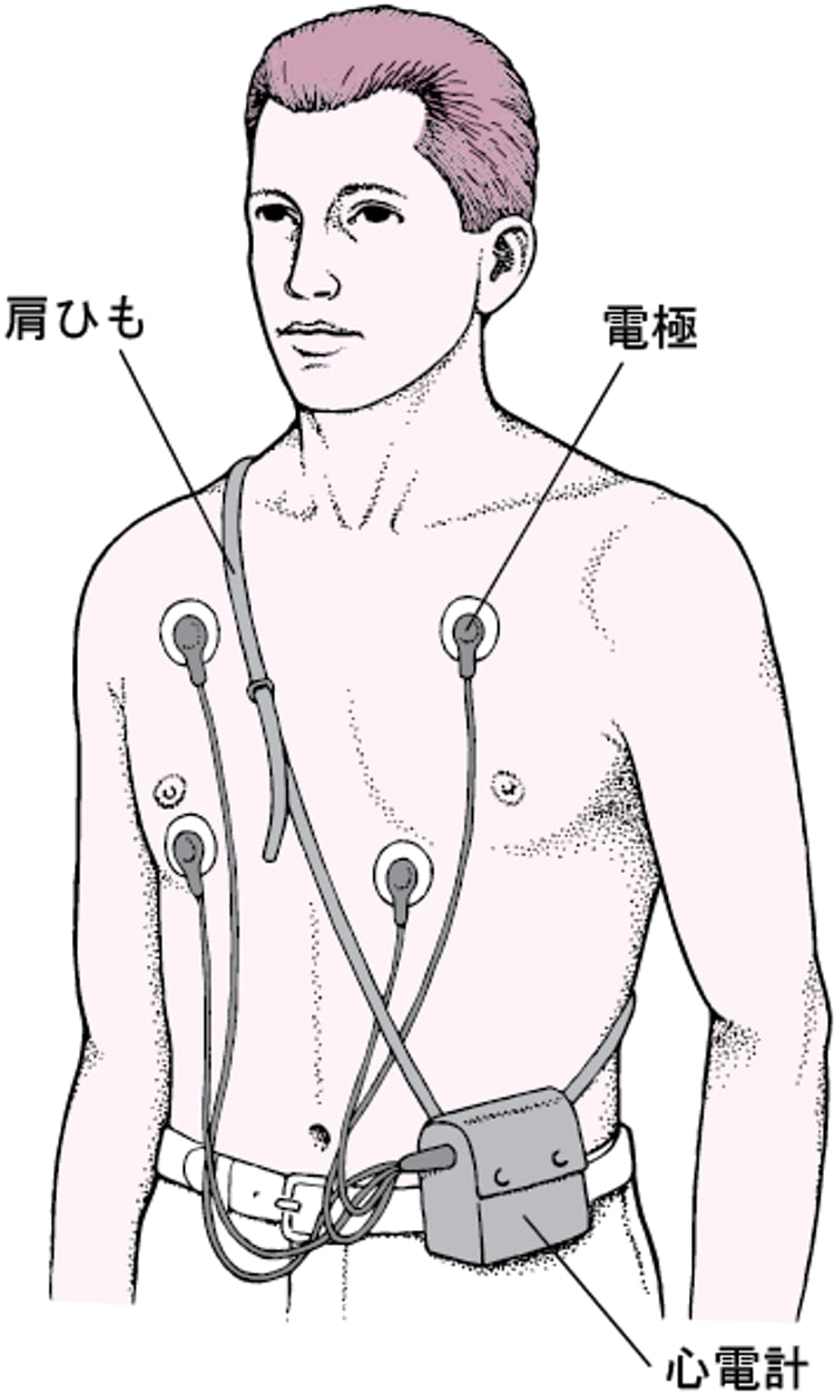 ホルター心電計による心電図の連続記録