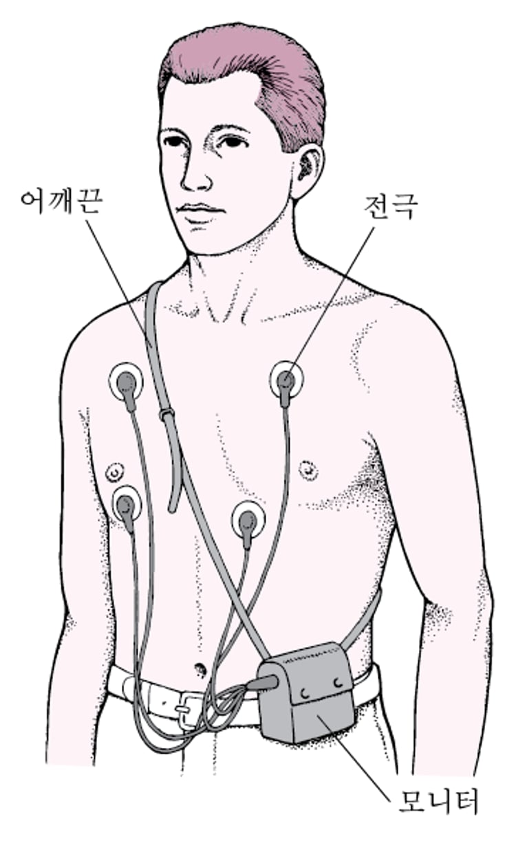 홀터 모니터: 지속적인 ECG 판독치
