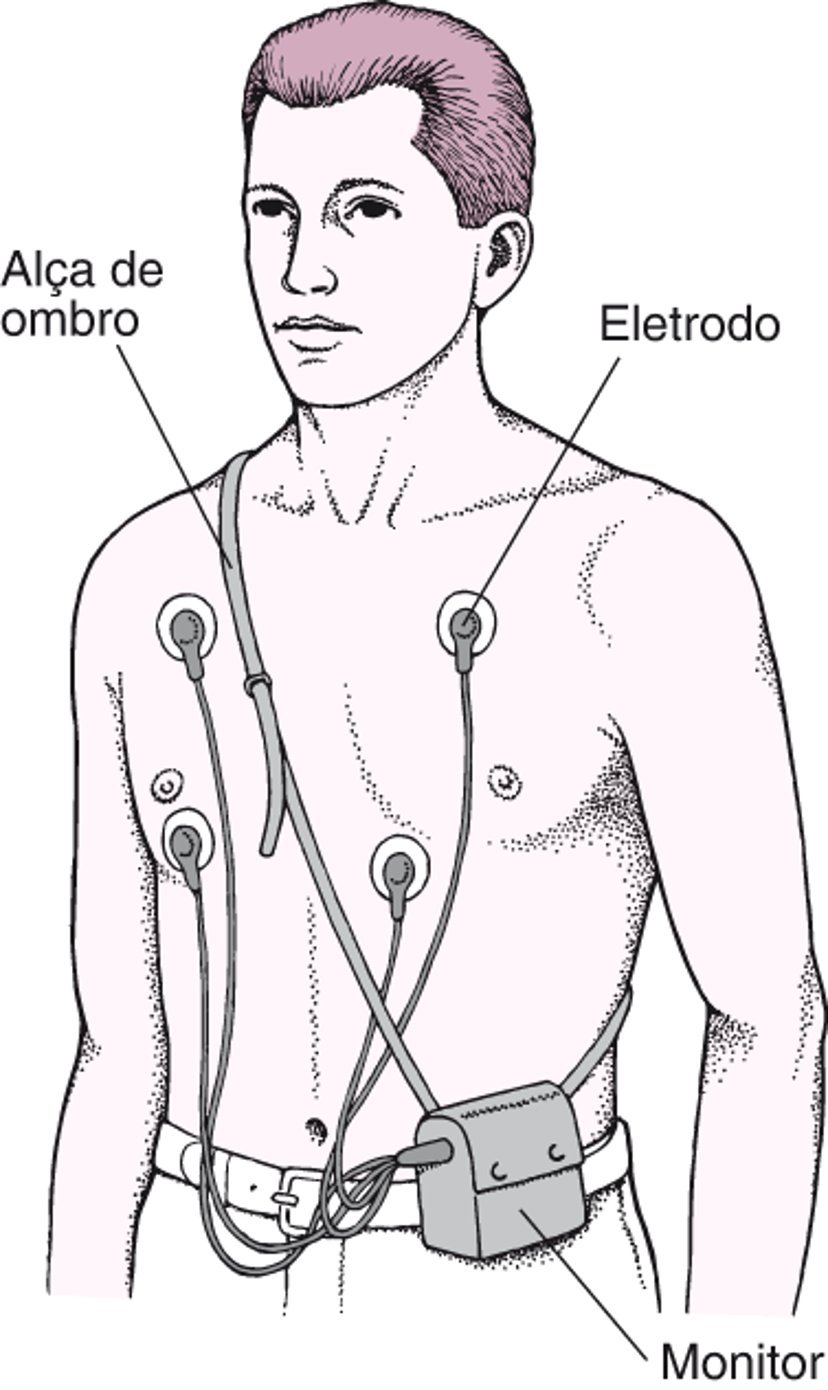 Monitor Holter: Leituras de ECG contínuas