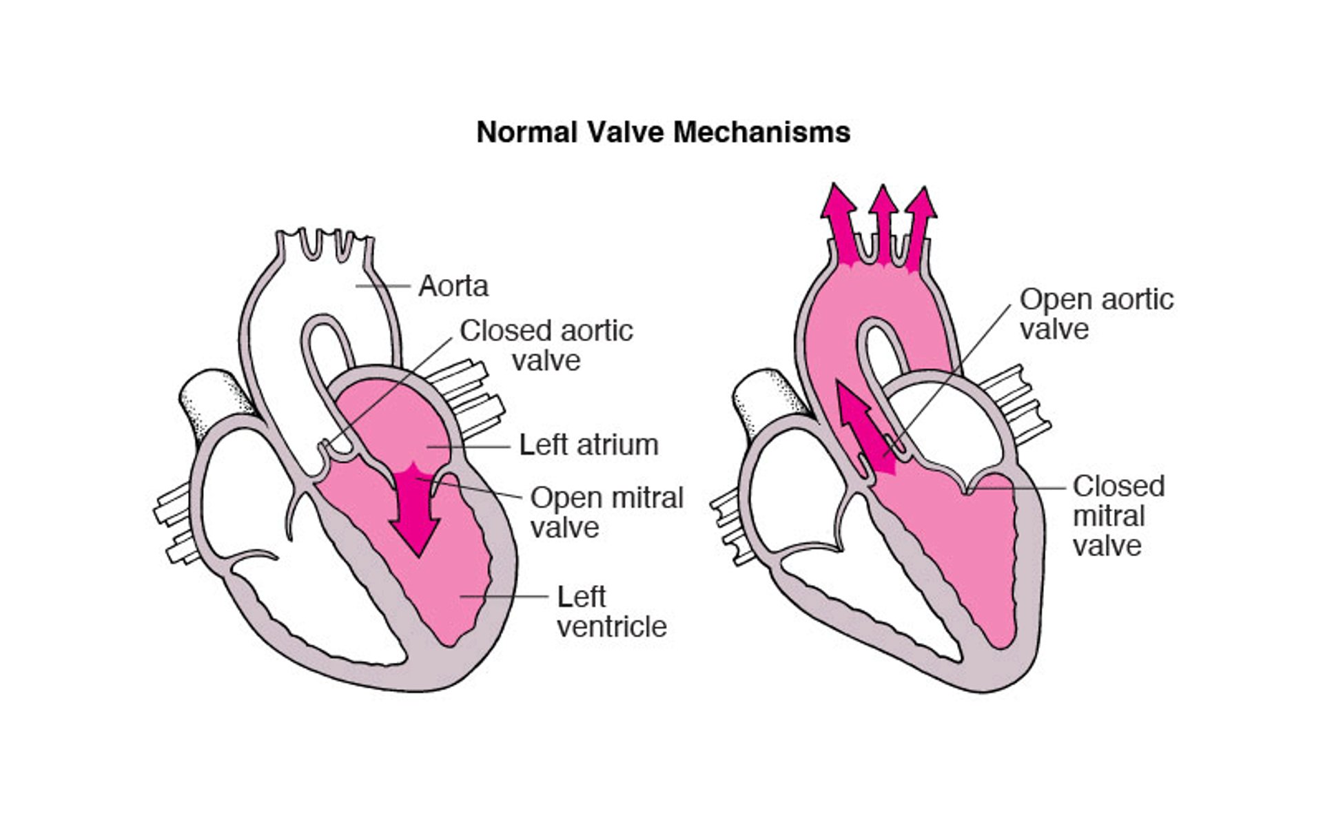 Understanding Stenosis and Regurgitation