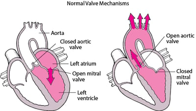 Understanding Stenosis and Regurgitation