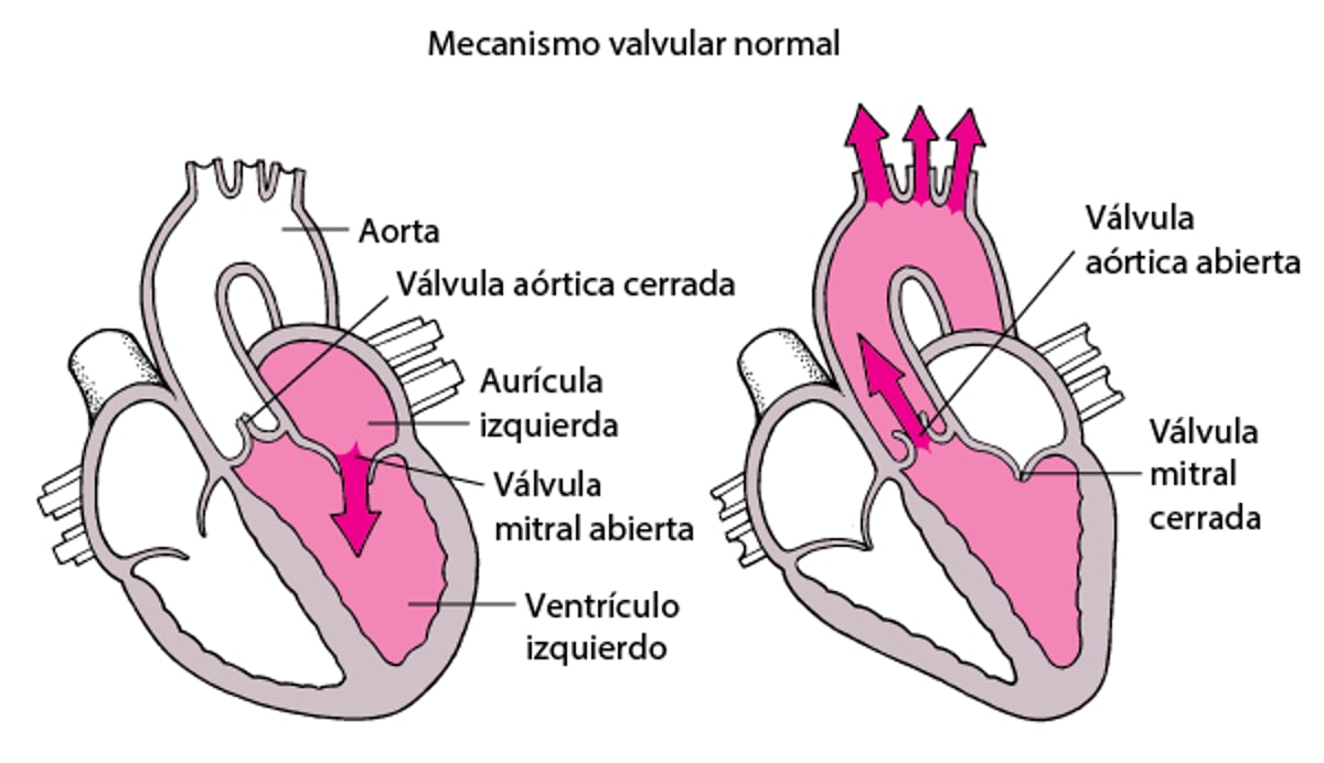 Qué son la estenosis y la regurgitación
