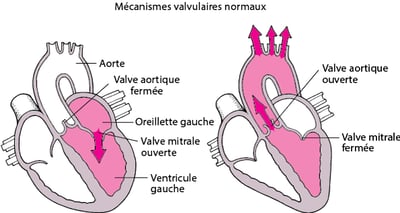 Comprendre la sténose et la régurgitation