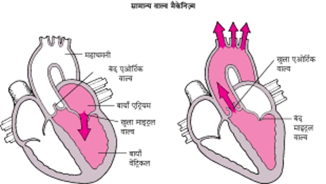 स्टीनोसिस और रीगर्जिटेशन को समझना