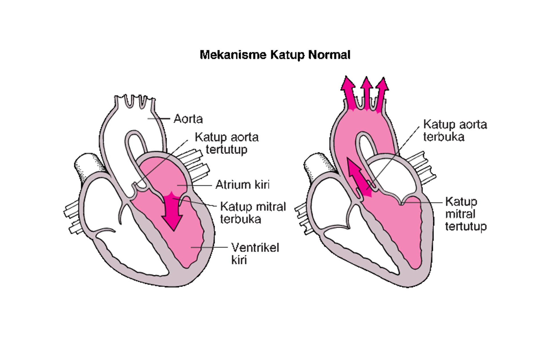Memahami Stenosis dan Regurgitasi