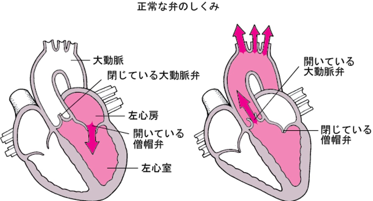 弁の狭窄と逆流について
