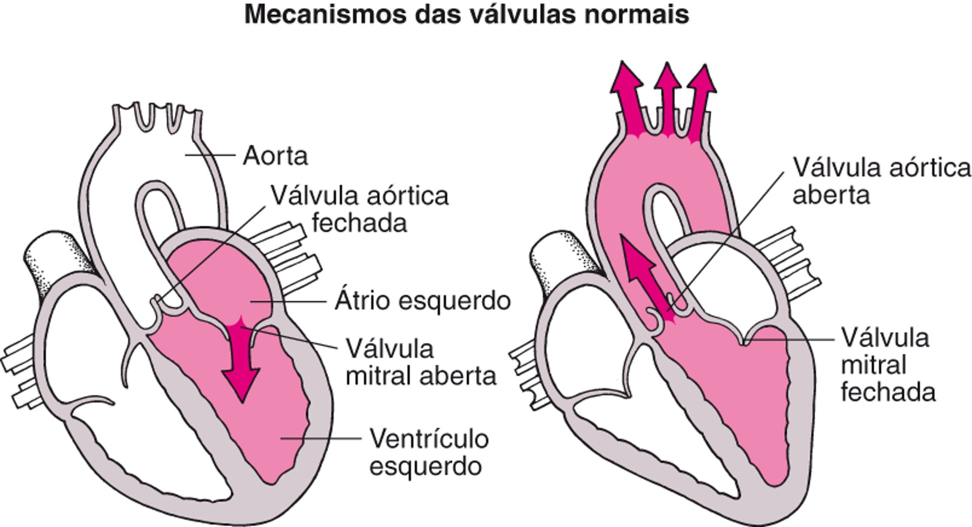 Compreender a estenose e a regurgitação