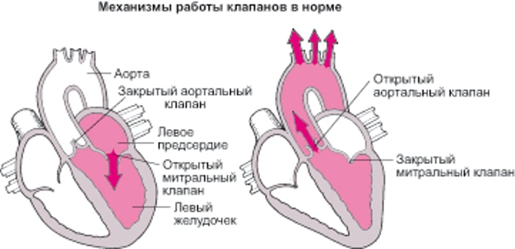 Объяснение стеноза и регургитации