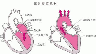 了解瓣膜狭窄和反流