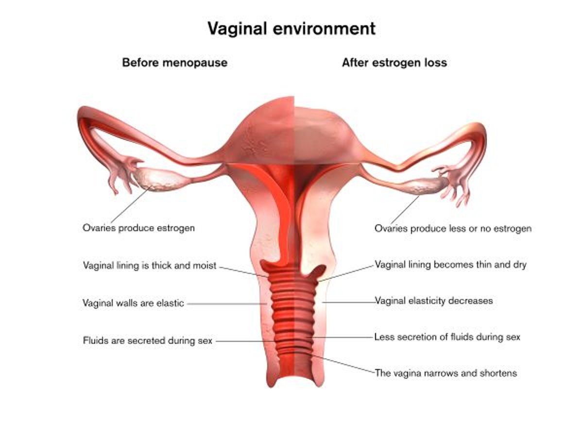 Effets de la ménopause sur le vagin