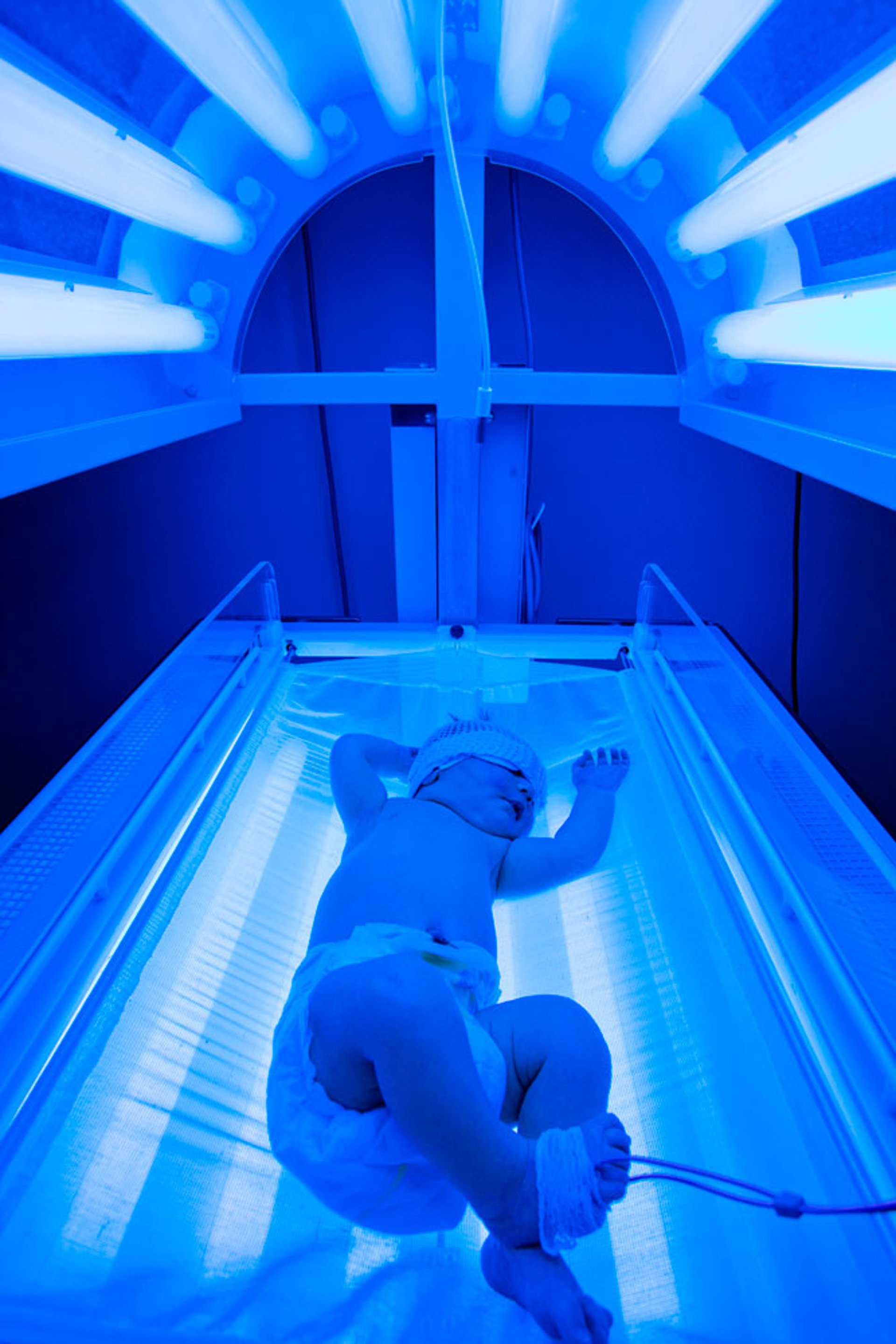 Phototherapy or "Bili Lights"