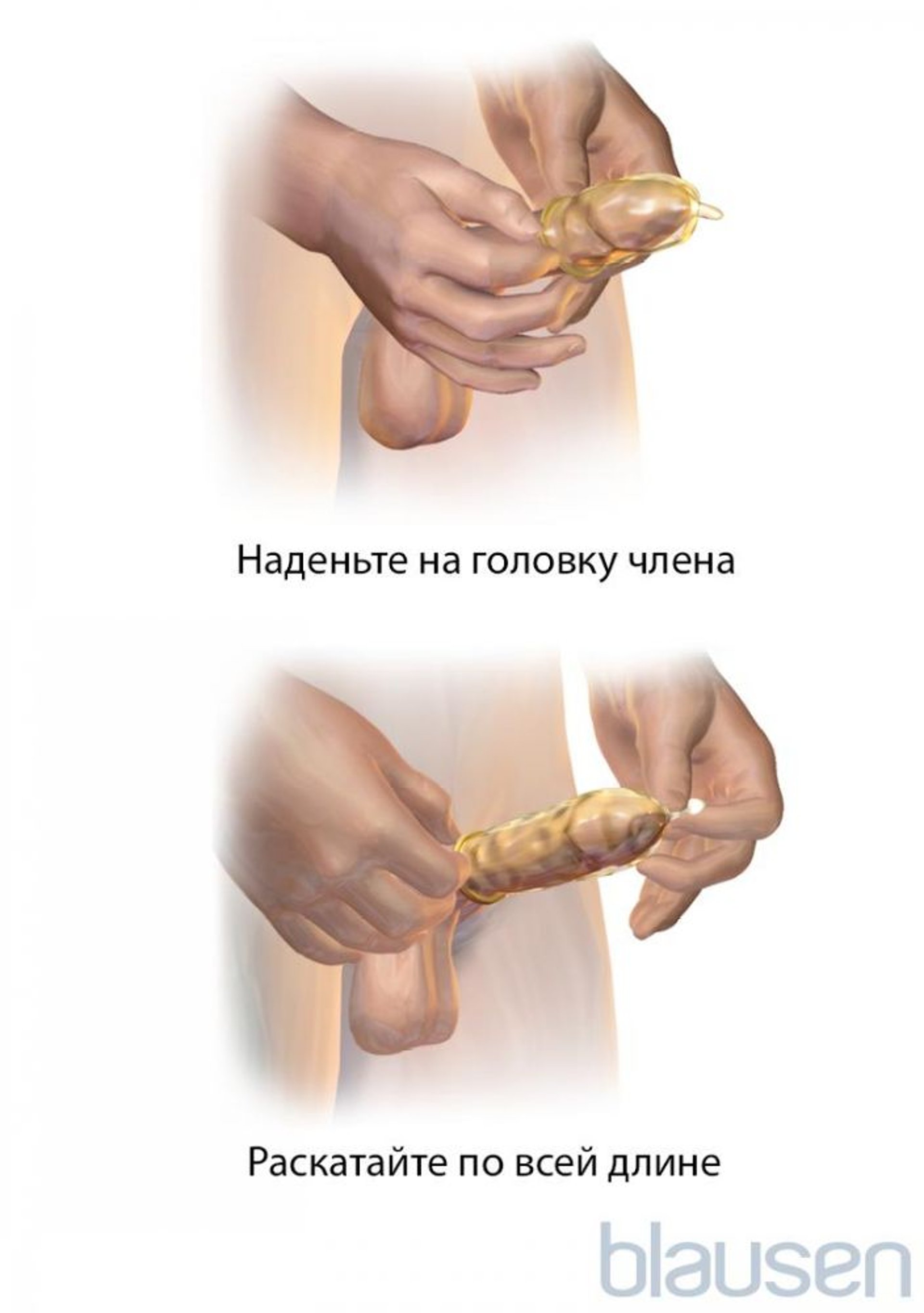 Как надевать наружный презерватив