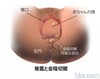 出産中の発露