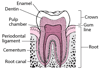 Tooth