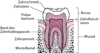 Dent