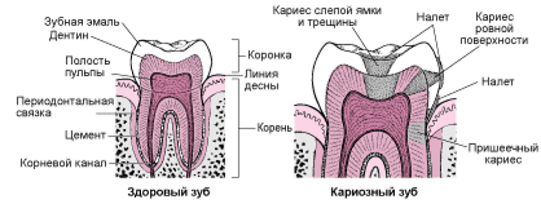Виды полостей