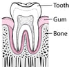 Periodontitis: From Plaque to Tooth Loss