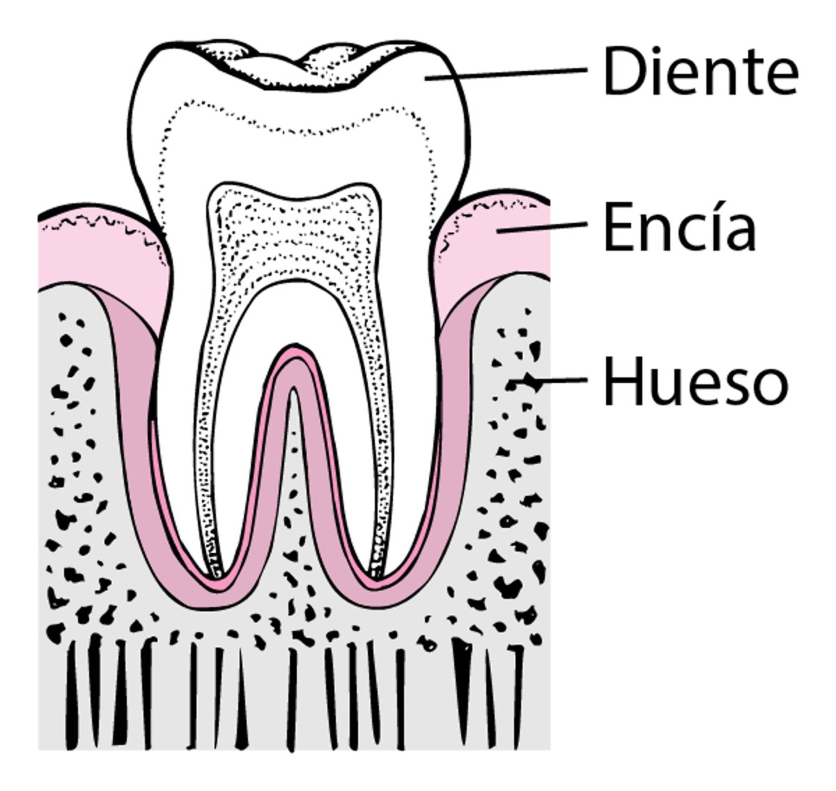 Periodontitis: de la formación de placa a la pérdida del diente