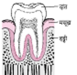 पेरियोडोंटाइटिस: प्लाक से दांत झड़ने तक