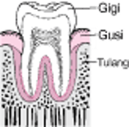 Periodontitis Dari Plak hingga Kehilangan Gigi
