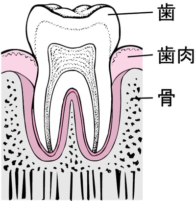 歯周炎：歯垢の蓄積から歯の喪失へ