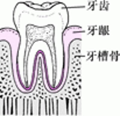 牙周炎：从菌斑堆积到牙齿松动的过程