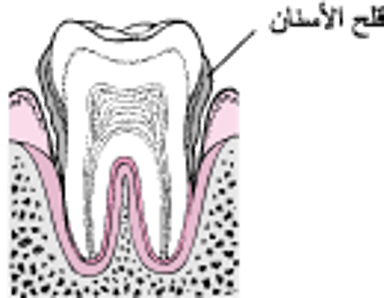 مراحل التهاب النسج الداعمة للأسنان: ابتداءً من تراكم اللويحة البكتيرية وانتهاءً بفقدان الأسنان